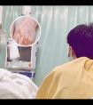 抹他克莫司软膏注意事项和禁忌